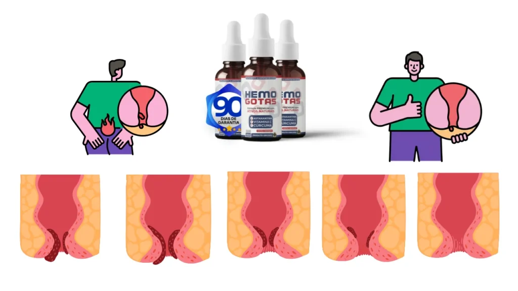 Hemogotas - evolução do uso de Hemogotas (imagens ilustrativa).