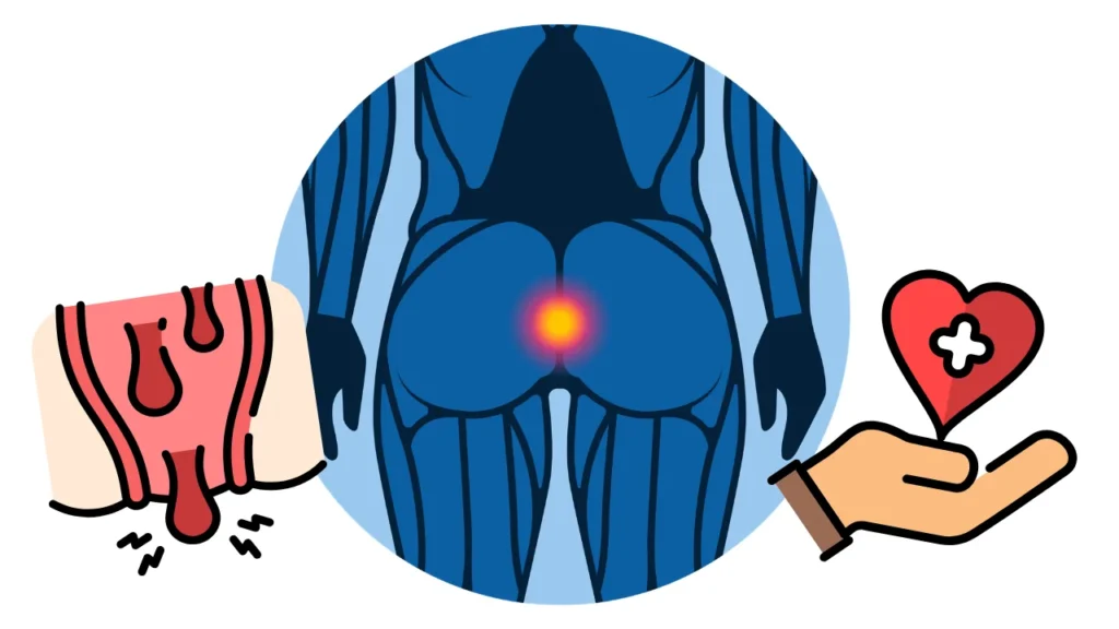 hemorroida tem cura e tratamentos hemorroida