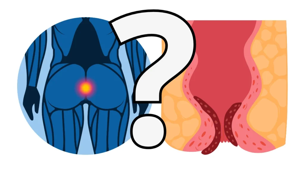 o que são hemorroidas